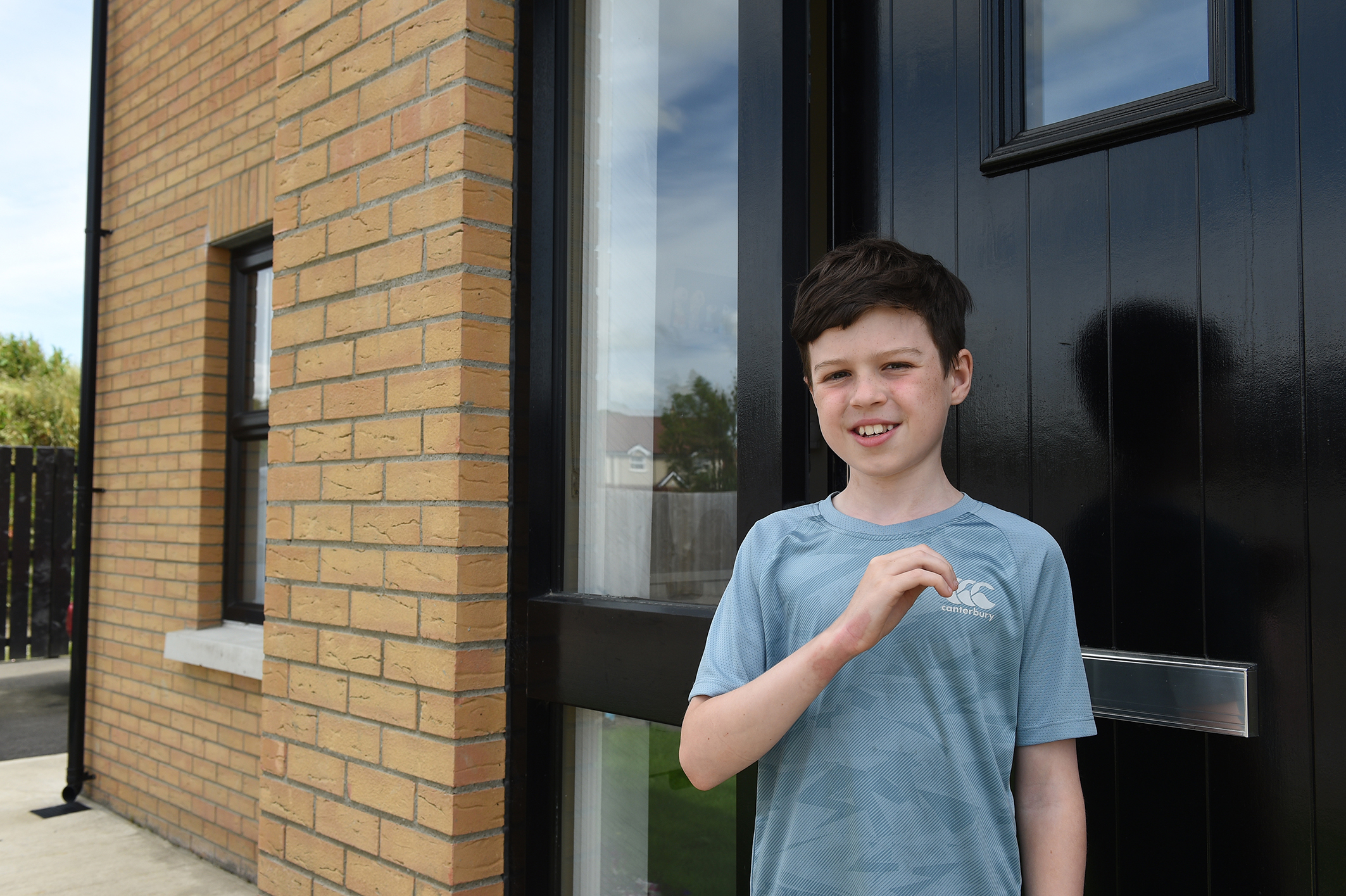 Warning after 11-year-old sustains nasty hogweed burn